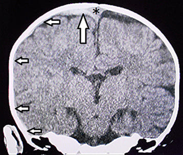 journal article