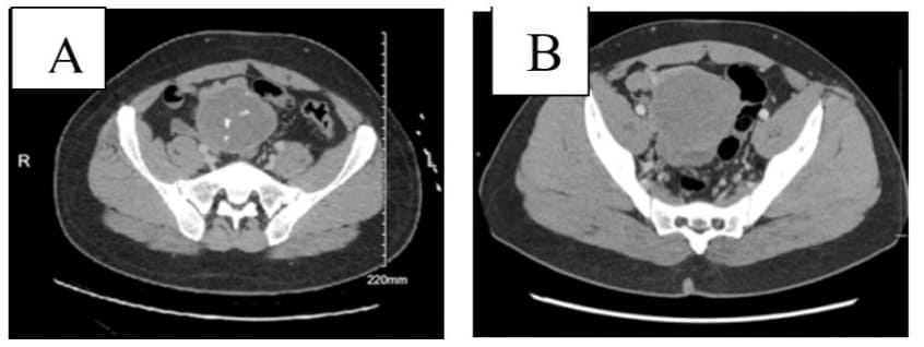 journal article