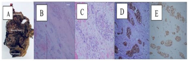 journal article