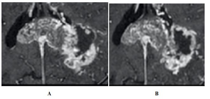 journal article