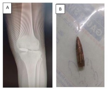 Article Figure