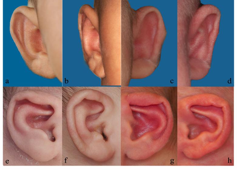 Article Figure