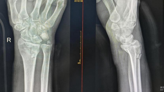 Article Figure