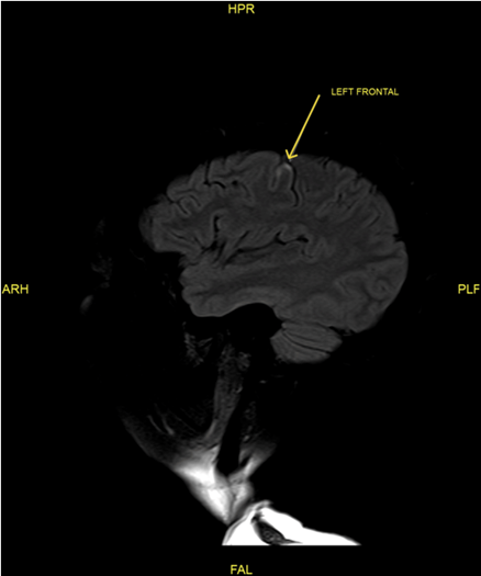 Article Figure