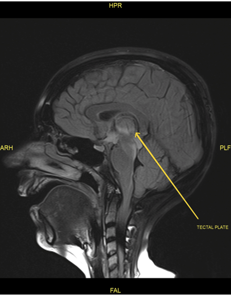 Article Figure