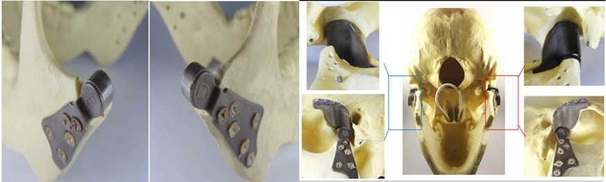 Article Figure