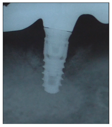 Article Figure