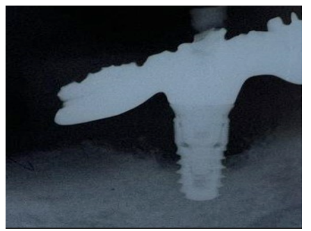 Article Figure