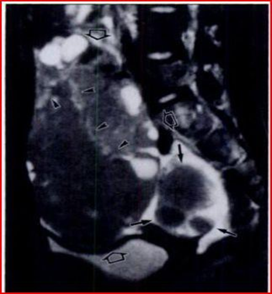 Article Figure