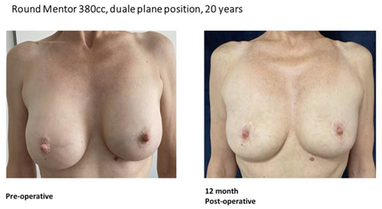 Article Figure