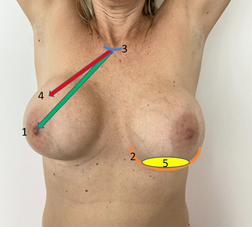 Article Figure