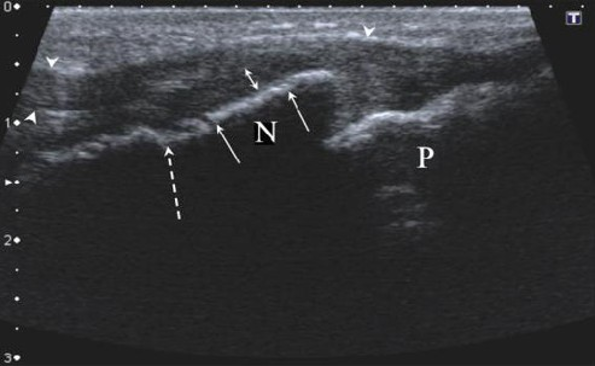 Article Figure