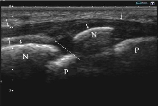 Article Figure
