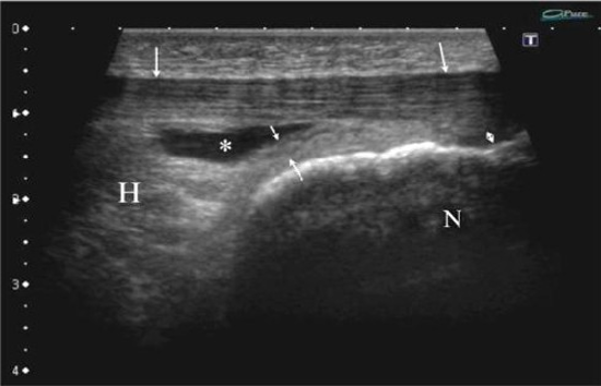 Article Figure