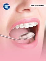 Clinical Trial Designs for the Testing of OTC Products for Dentine Hypersensitivity-A Systematic Review