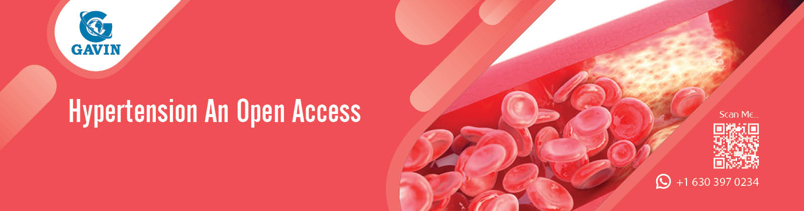 Hypertension An Open Access